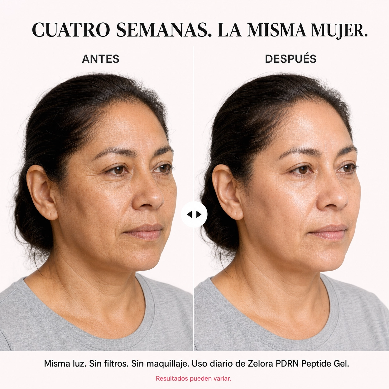 Zelora PDRN Cream