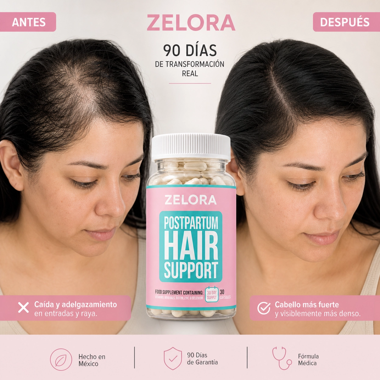 ZELORA POSTPARTO · VITAMINA CAPILAR